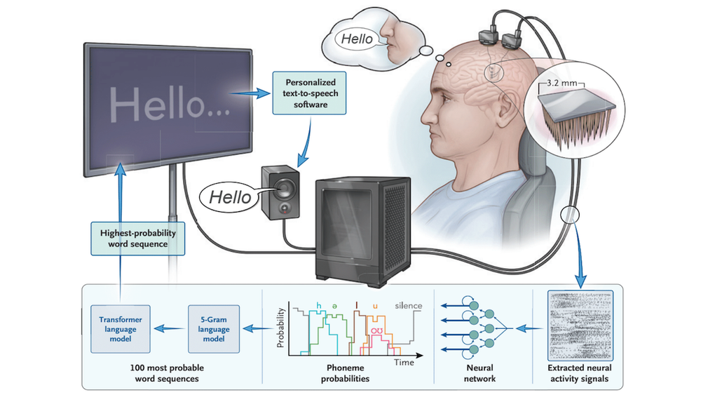 Breakthrough Brain-Computer Interface Translates Neural Activity into Speech